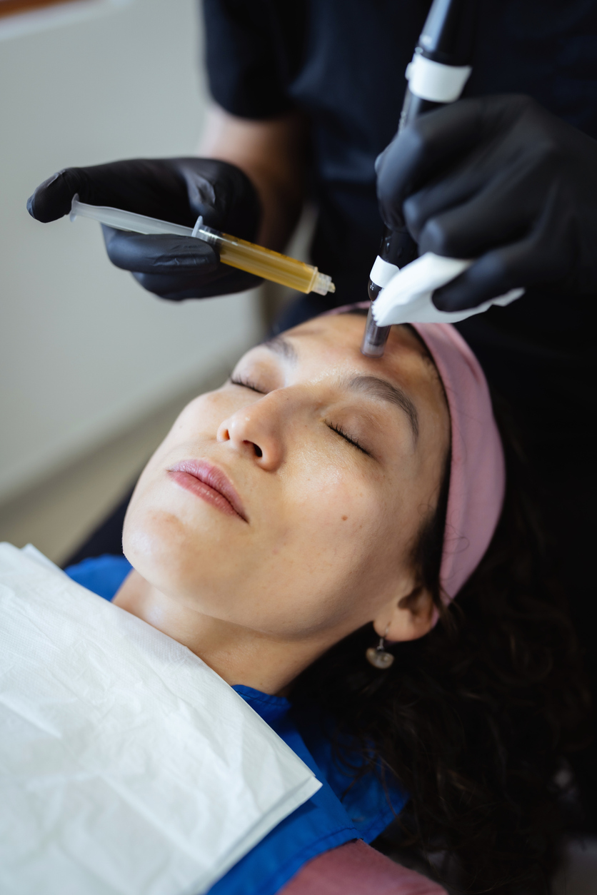 Beautician applying platelet-rich plasma with dermapen on patient's forehead Beautician injecting platelet-rich plasma into patient's forehead using a dermapen for skin rejuvenation treatment
